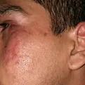 Facebook: sujeto denuncia brutal agresión en un partido de fútbol