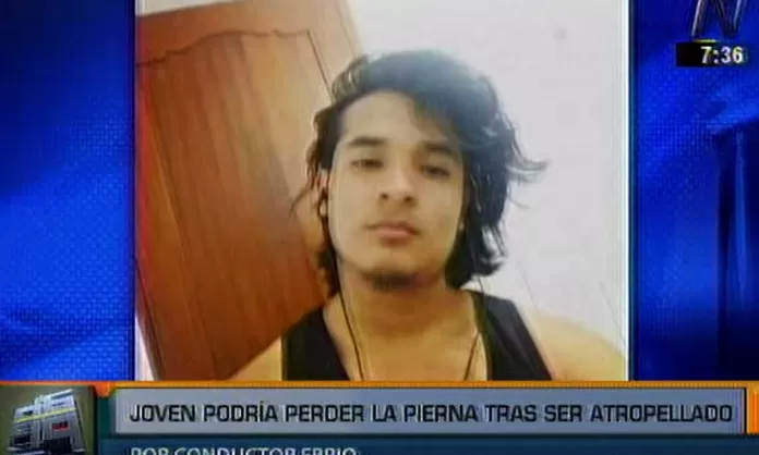 Joven Atropellado Por Conductor Ebrio Podr A Perder La Pierna Canal N