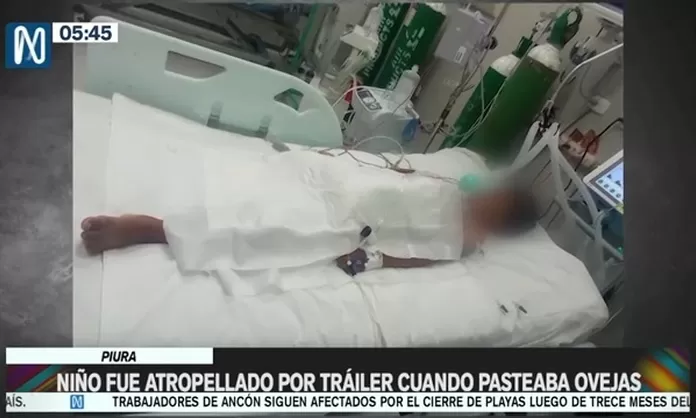 Piura Ni O Fue Amputado De Una Pierna Tras Ser Atropellado Por Tr Iler