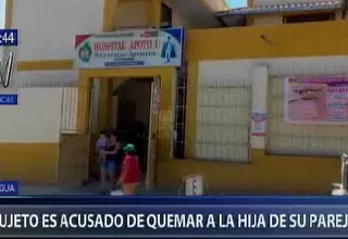 Bagua: denuncian que sujeto quemó con agua hirviendo a la hija de su pareja