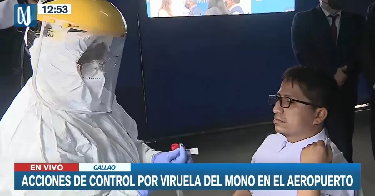 Callao: Acciones de control por viruela del mono en el aeropuerto Jorge Chávez