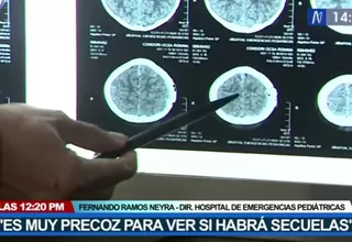 Caso de menor agredida con ladrillo: Médico señala que es precoz conocer si tendrá secuelas