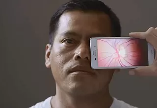 Dispositivo convierte a tu smartphone en herramienta para detectar males en la vista  
