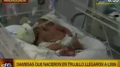 Llegaron a Lima las siamesas recién nacidas en Trujillo - Noticias de siamesas