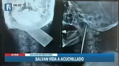 Médicos operaron con éxito a hombre que tenía un cuchillo de cocina en el cuello - Noticias de hospital-victor-larco-herrera