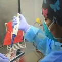 Ministerio de Salud avanza negociaciones para vacuna contra la viruela del mono
