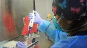 Ministerio de Salud avanza negociaciones para vacuna contra la viruela del mono - Noticias de vacuna pfizer