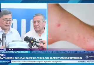 Minsa reporta más de 140 casos de virus coxsackie en Lima y refuerza medidas de prevención