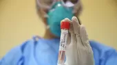 Coronavirus: Personas con síntomas pueden realizarse pruebas moleculares gratuitas en centros de salud - Noticias de sintomas