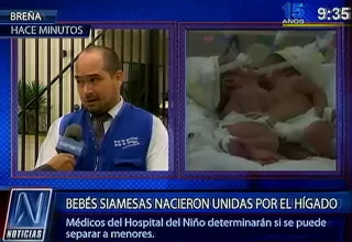 SIS cubrirá los gastos de tratamiento médico a siamesas que nacieron en Trujillo