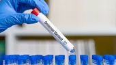 Argentina detecta su primer caso de ómicron en viajero procedente de África - Noticias de Coronavirus