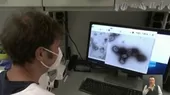Chile: confirmó un nuevo caso de viruela del mono - Noticias de fernando-del-rincon