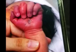 China: madre intentó comerse el brazo de su hijo recién nacido