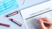 Coronavirus: Laboratorio francés comercializará en Estados Unidos test rápido del covid-19 - Noticias de laboratorio-movil