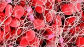 Anticoagulantes pueden mejorar un 50 % la supervivencia de pacientes con COVID-19, según estudio  - Noticias de estudio-laub-quijandria
