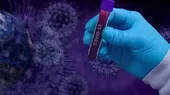 Personas con tipo de sangre O tendrían menor riesgo de infección por coronavirus, según estudios - Noticias de infeccion