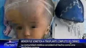 Menor fue sometida a trasplante completo de cráneo - Noticias de hidrocefalia