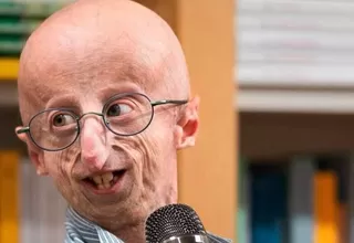 Falleció Sammy Basso, el científico que visibilizó la progeria