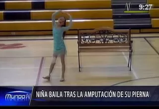 Niña baila tras amputación de su pierna 