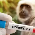 OPS: América es el epicentro del brote de viruela del mono