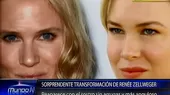 La sorprendente transformación de Renée Zellweger - Noticias de renee-zellweger