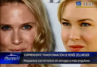 La sorprendente transformación de Renée Zellweger