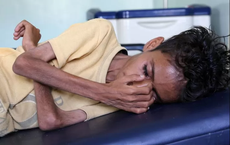 yemen-85-000-ni-os-han-muerto-de-hambre-en-los-ltimos-cuatro-a-os